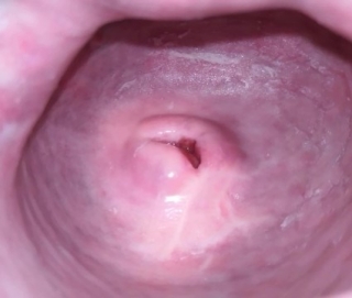 Kamerával kukkantottak be egy punciba